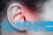 Top Features In Tinnitus-Treating Devices